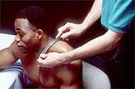 treatment (shoulder)